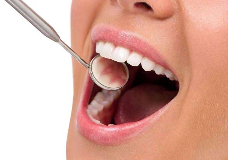 Kontrola ústní hygieny pomocí dentálního zrcátka.