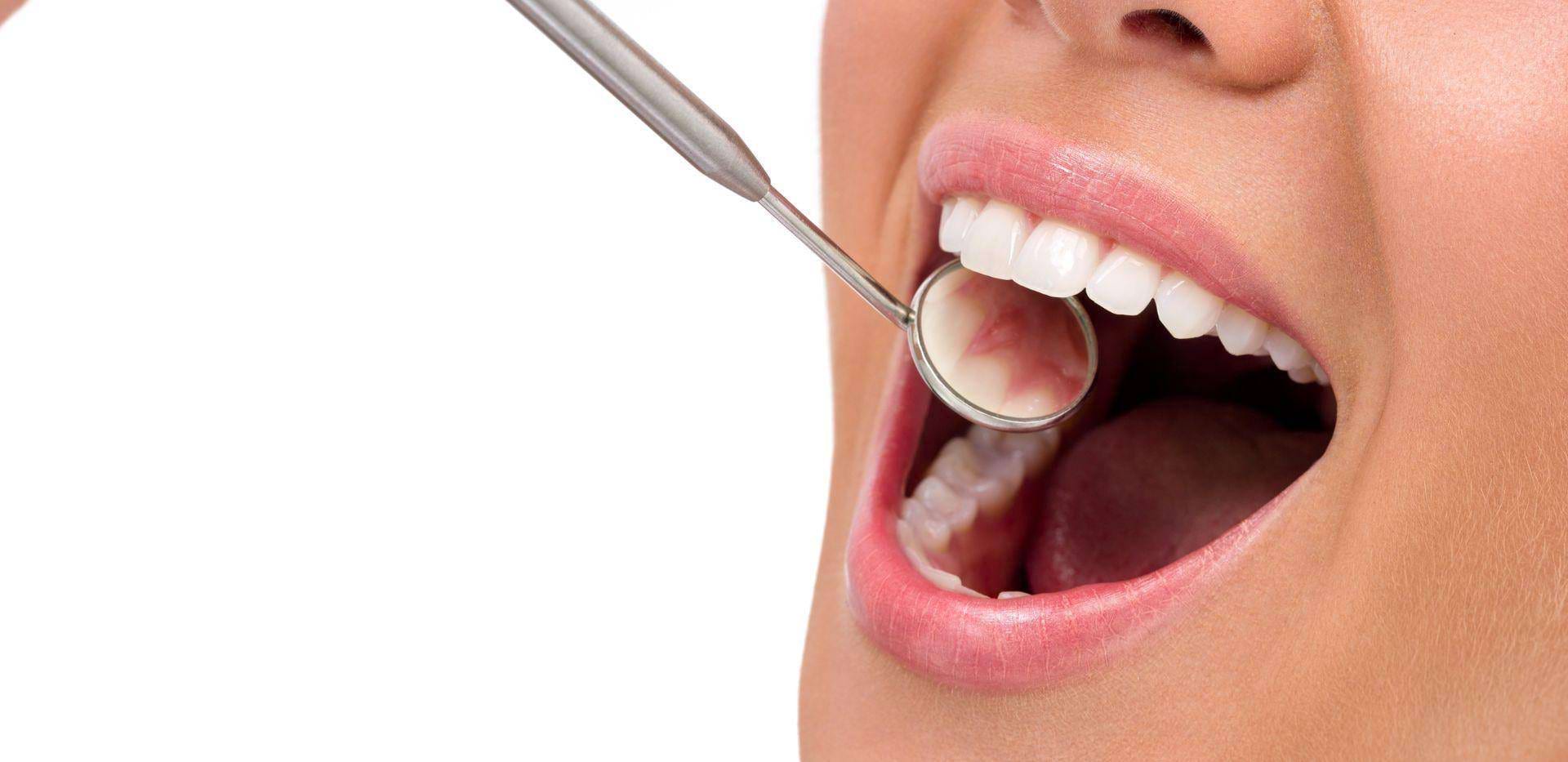 Skontrolovanie ústnej hygieny pomocou dentálneho zrkadielka.