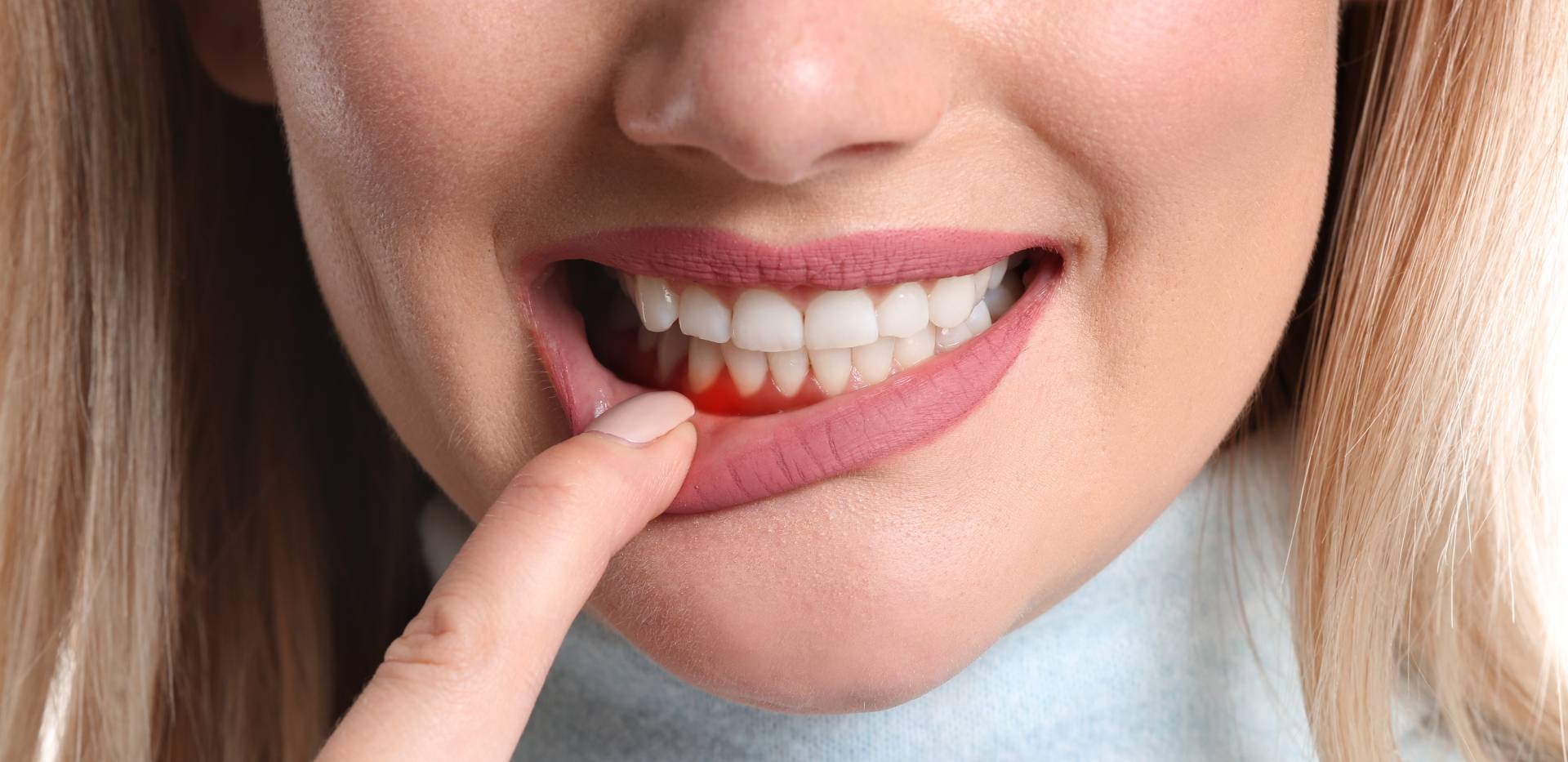 Empfindliches Zahnfleisch? Drei überraschende Ursachen