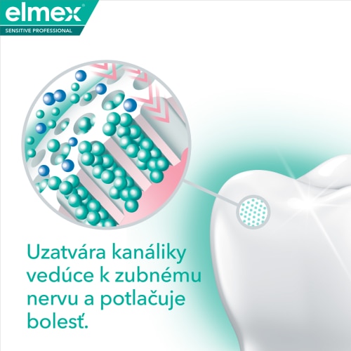 Schéma zuba ukazujúca, ako zubná pasta elmex uzatvára kanáliky vedúce k nervu a blokuje bolesť. 