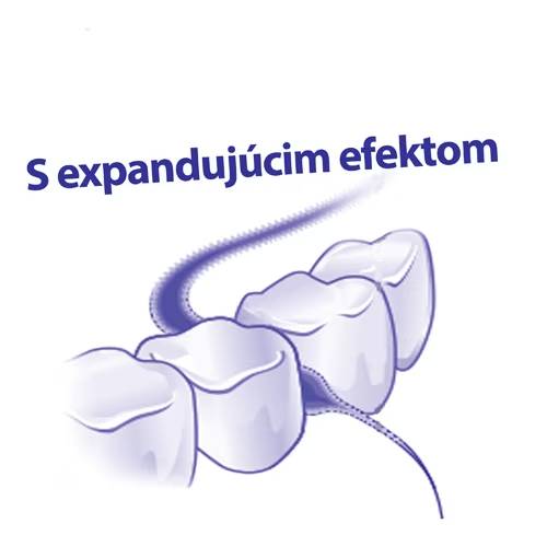 Ilustrácia zubnej niti s expanzívnym efektom medzi zubami.
